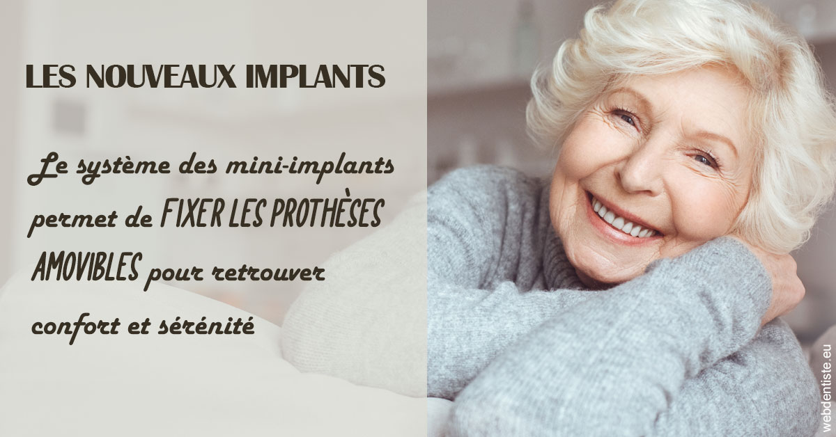 https://selarl-couchat-et-associes.chirurgiens-dentistes.fr/Les nouveaux implants 1