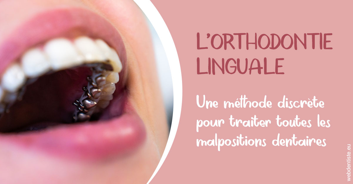 https://selarl-couchat-et-associes.chirurgiens-dentistes.fr/L'orthodontie linguale 2