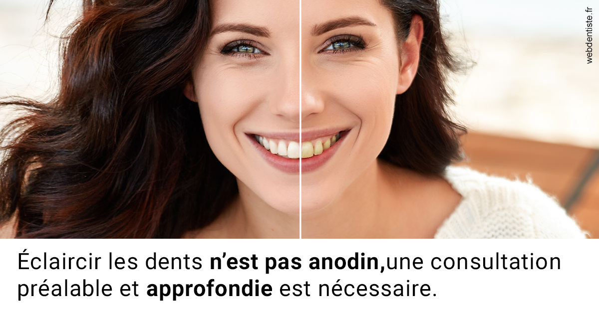 https://selarl-couchat-et-associes.chirurgiens-dentistes.fr/Le blanchiment 2
