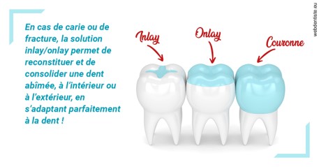 https://selarl-couchat-et-associes.chirurgiens-dentistes.fr/L'INLAY ou l'ONLAY