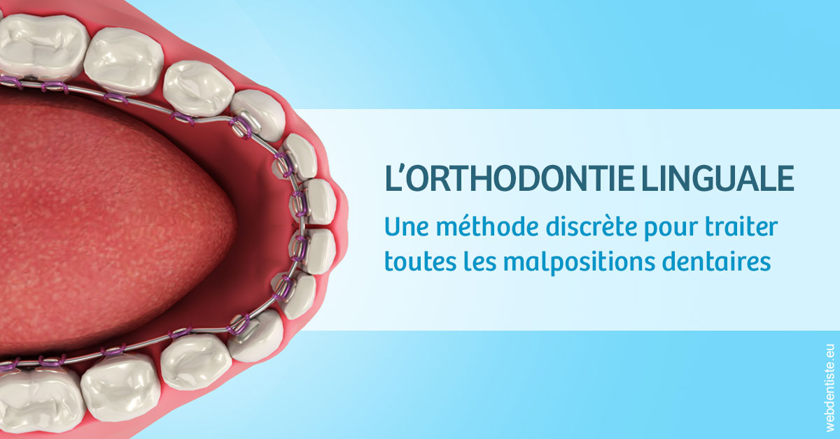 https://selarl-couchat-et-associes.chirurgiens-dentistes.fr/L'orthodontie linguale 1