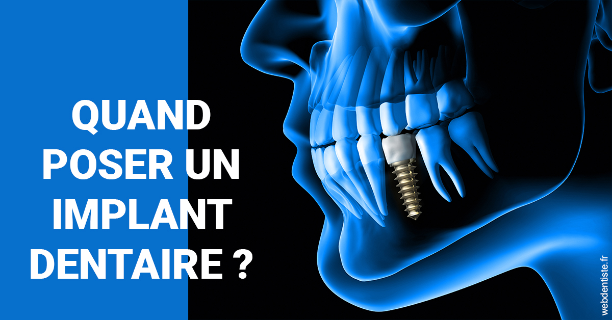 https://selarl-couchat-et-associes.chirurgiens-dentistes.fr/Les implants 1