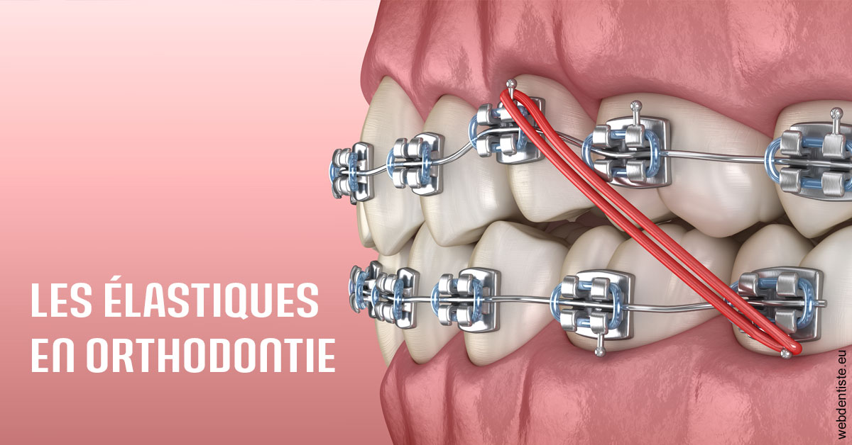 https://selarl-couchat-et-associes.chirurgiens-dentistes.fr/Elastiques orthodontie 2