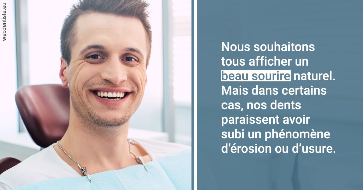 https://selarl-couchat-et-associes.chirurgiens-dentistes.fr/Érosion et usure dentaire