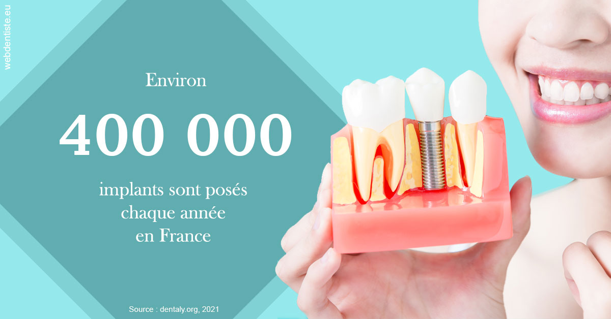 https://selarl-couchat-et-associes.chirurgiens-dentistes.fr/Pose d'implants en France 2